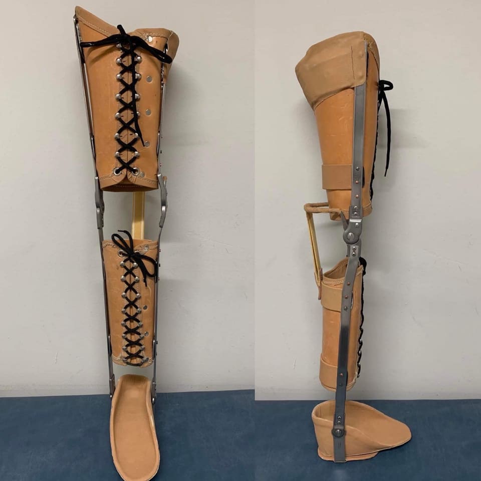 Custom KAFO leg orthosis with leather cuffs, metal side bars and a knee joint, front and side view
