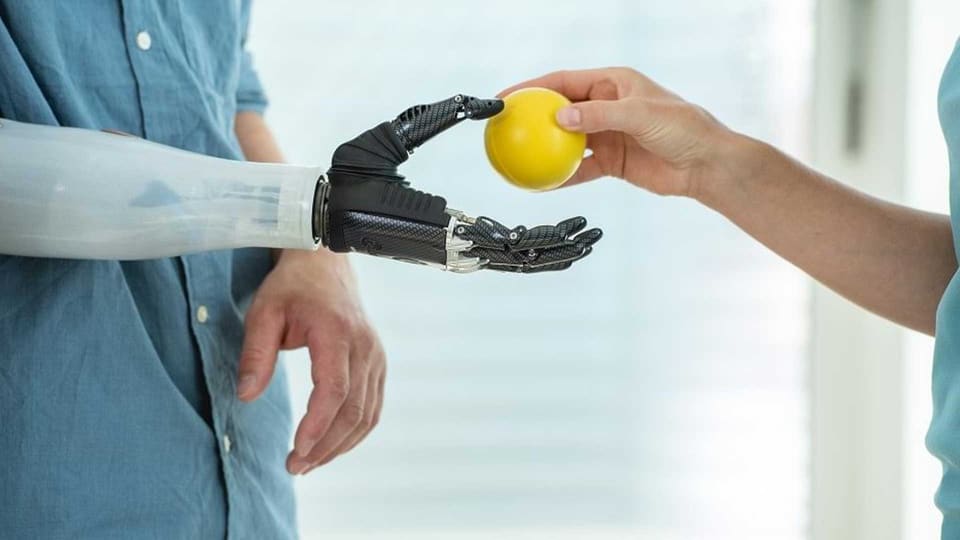 Myoelectric below-elbow prosthesis gripping a small ball – prosthetic hand, upper-limb prosthetics