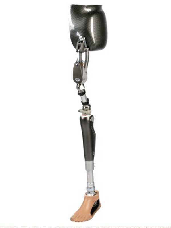 Hip disarticulation prosthesis with a carbon pelvic socket, Ottobock Helix3D hip joint, knee and foot