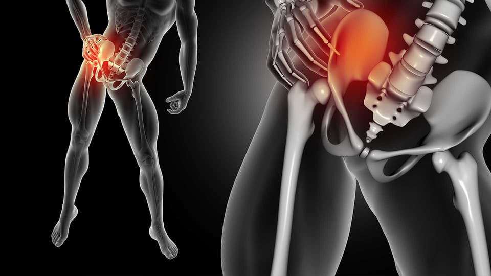Illustration of the pelvis and hip joint – hip disarticulation and lower limb prosthesis