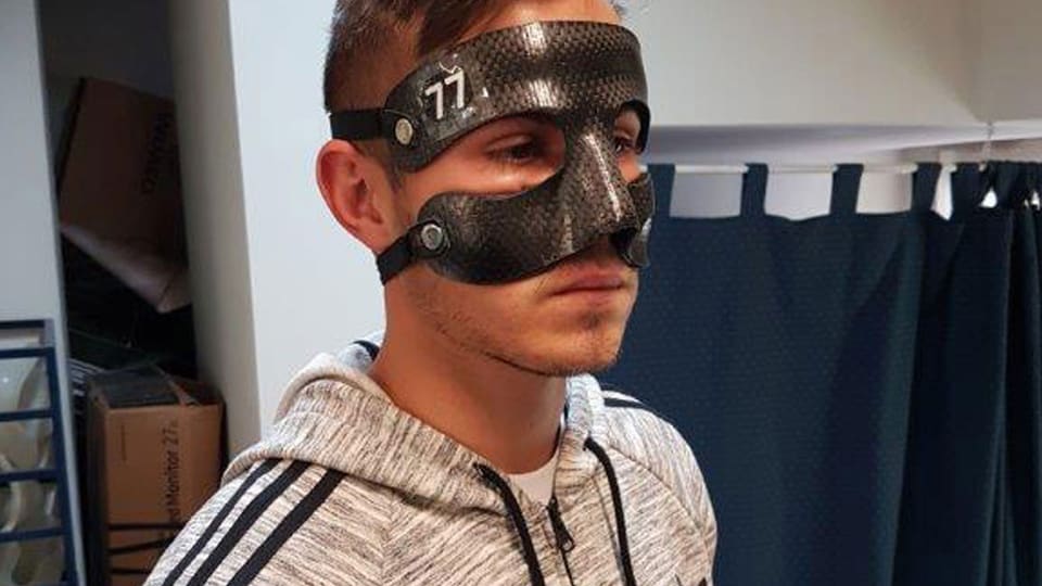 An athlete wearing a carbon protective mask for the nose and cheekbones, made to fit his face