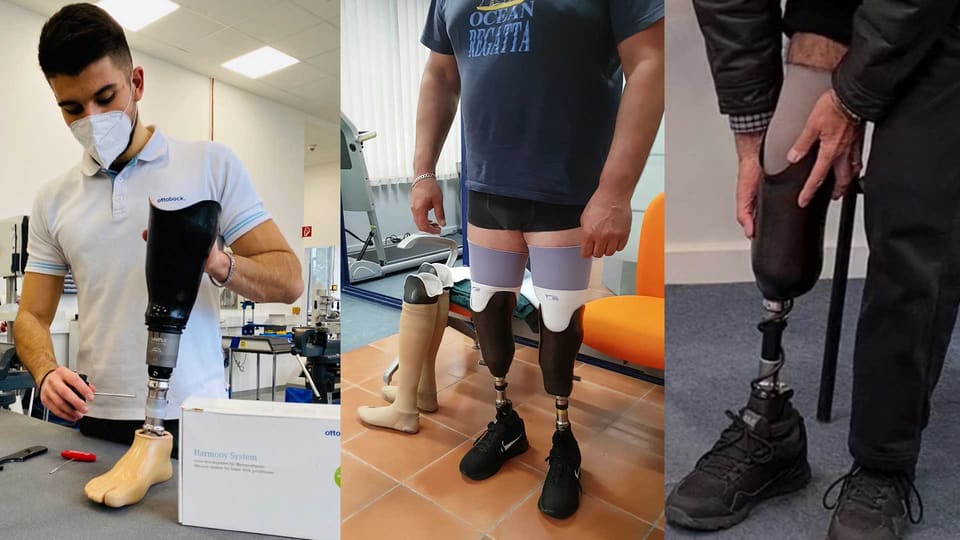 Below-knee prostheses: a prosthetist with the Harmony system, a user with two prostheses and a patient wearing a below-knee prosthesis