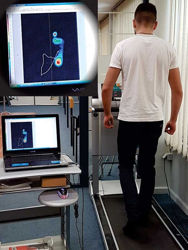 Digital foot scanner for plantar pressure analysis at Hlamidis Orthopaedic Center in Thessaloniki