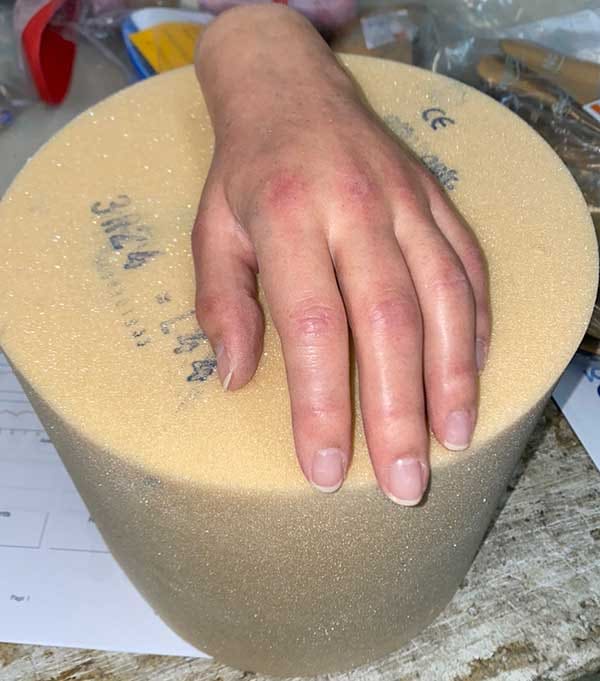Silicone hand prosthesis in the workshop, painted to match the skin tone