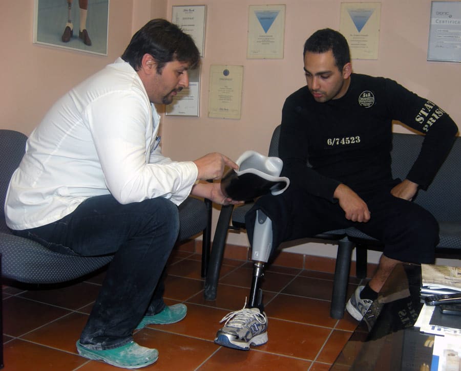 Hlamidis prosthetist examining a MAS Soft above-knee socket with an above-knee prosthesis user