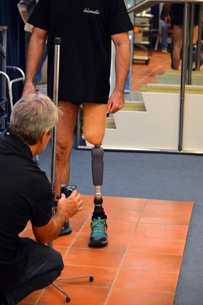 Above-knee prosthesis with a custom-made socket in the Hlamidis Orthopaedic Center workshop