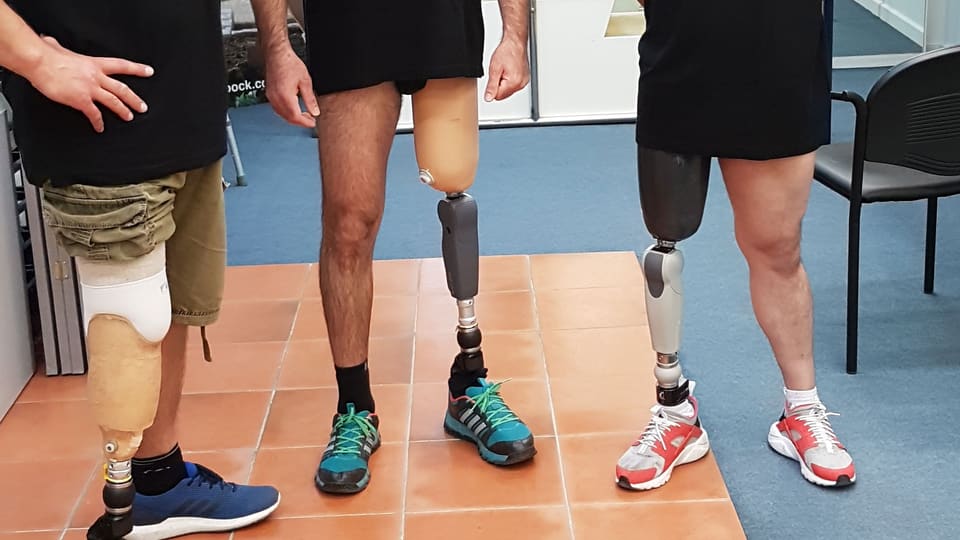Three users with different prosthetic legs, below-knee and above-knee, at the Hlamidis premises