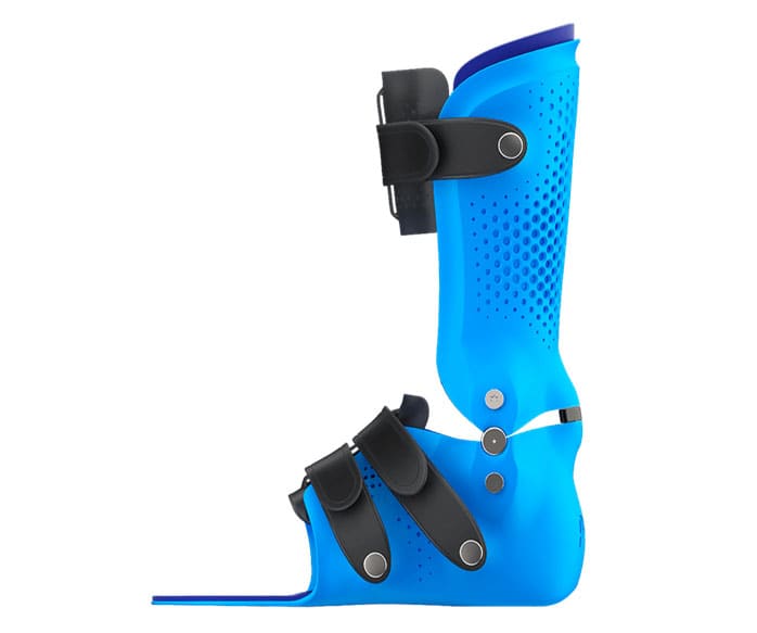 Blue 3D-printed paediatric ankle-foot brace