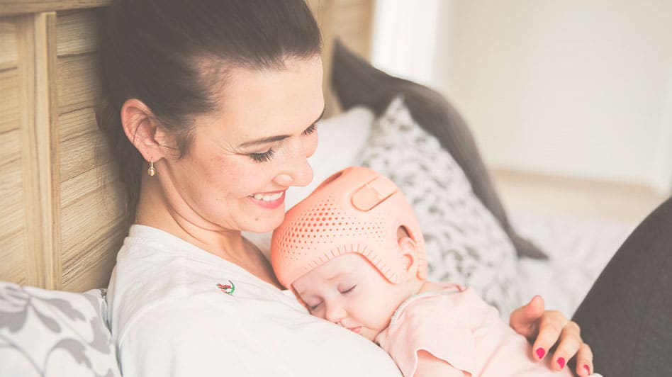 Mother hugging her sleeping baby, who is wearing a pink perforated 3D-printed plagiocephaly helmet