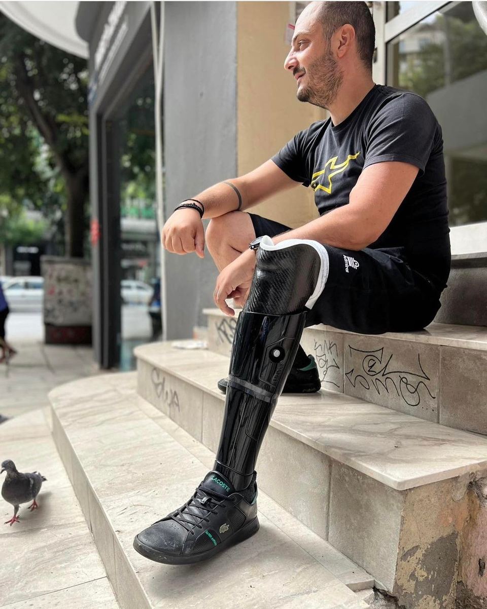 Below-knee prosthesis user with a black UNYQ prosthetic cover sitting on steps in Thessaloniki