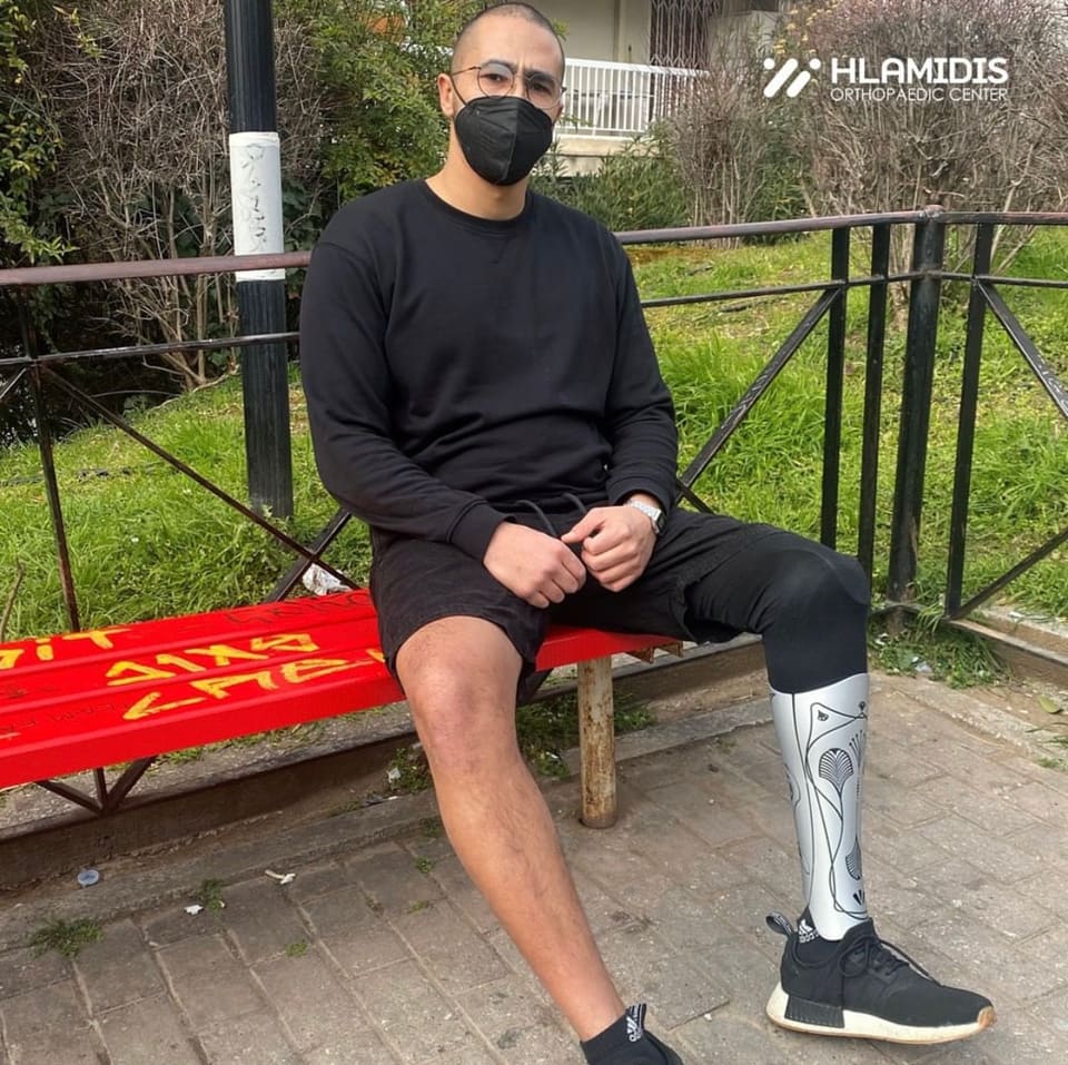 Below-knee prosthesis user with a patterned silver UNYQ cover, sitting on a bench