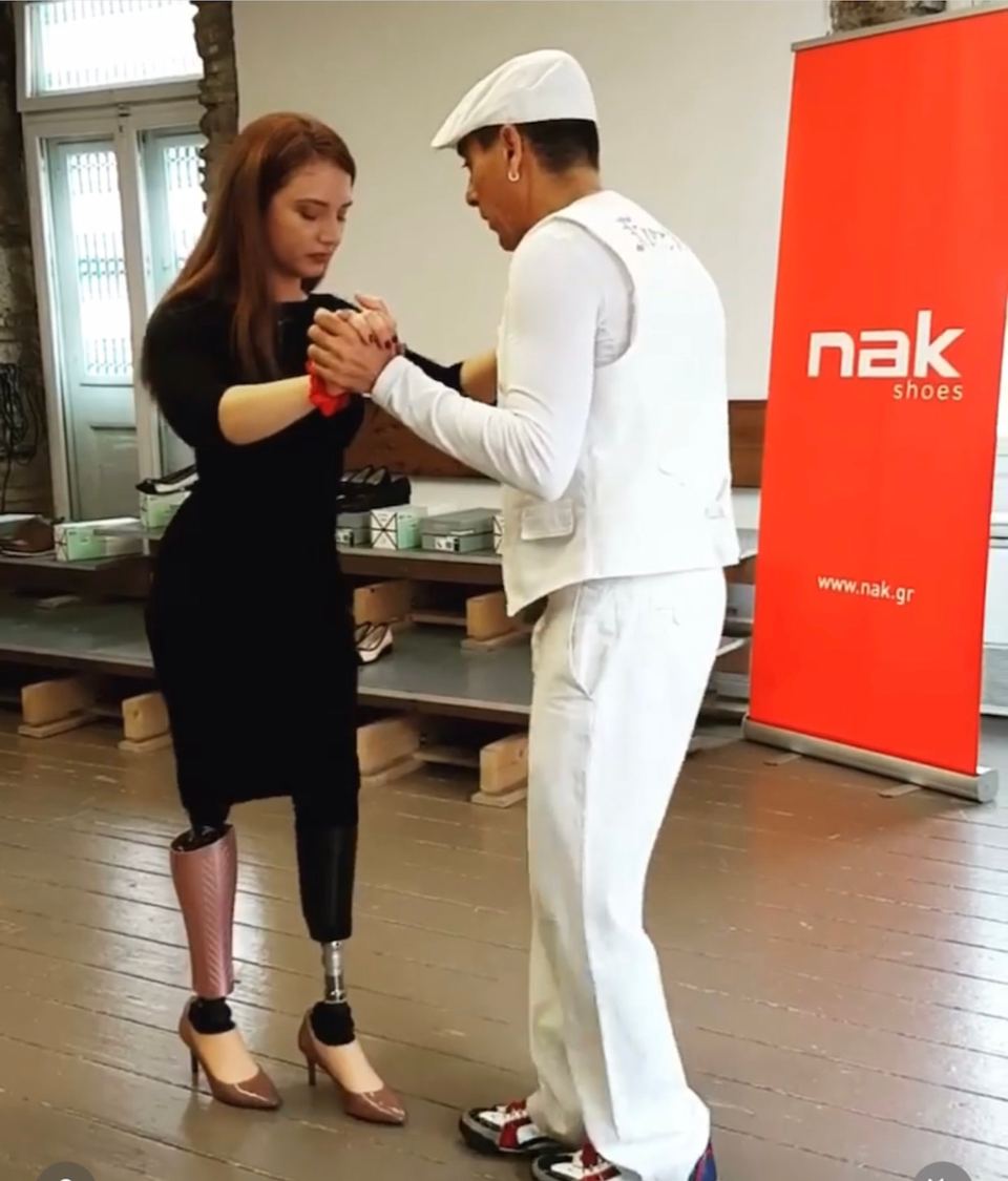 3D-printed UNYQ prosthetic cover on a prosthetic leg