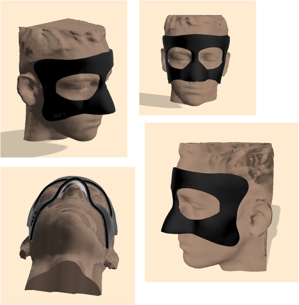 3D model of a protective nose mask designed on a digital scan of the face