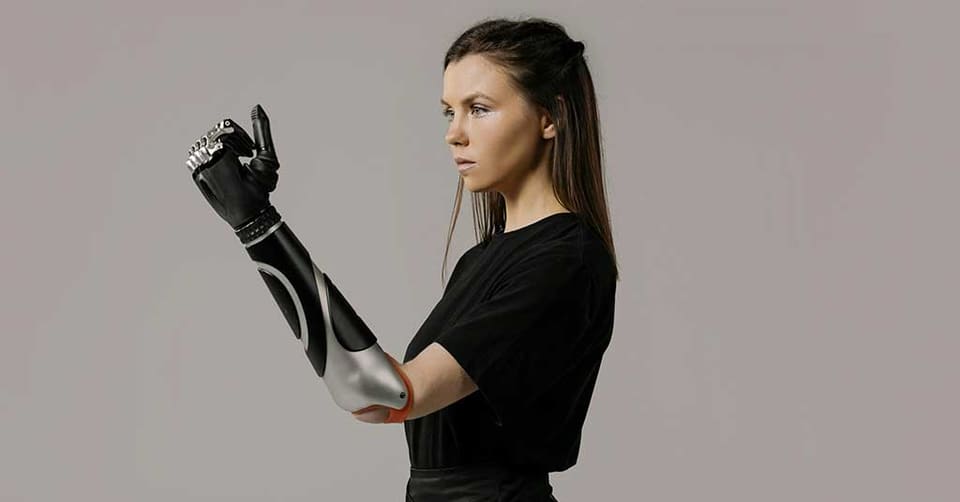 Prosthetic arms – myoelectric above-elbow prosthesis, Hlamidis Orthopaedic Center, Thessaloniki