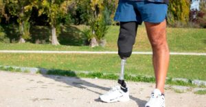 Ανάκτηση κινητικότητας με προσθετικό πόδι